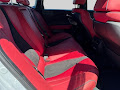 2025 Acura TLX A-Spec Package